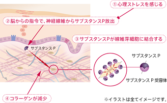 ストレスが老化を早める